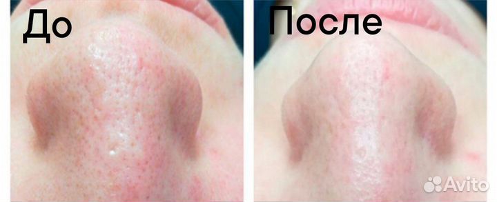 Косметолог эстетист
