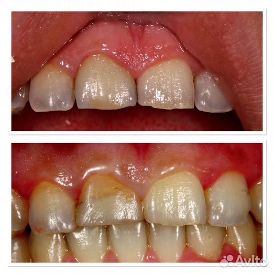 Услуги зуботехнической лаборатории(зубные протезы)
