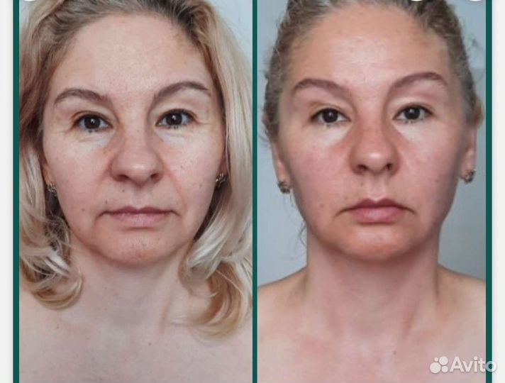 Моделирующий массаж лица и тела