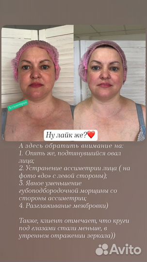 Лифтинг массаж лица