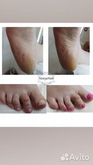 Мастер маникюра и педикюра,маникюр, педикюр