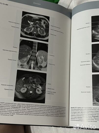 Лучевая анатомия. Грудь, живот, таз. Рентгенология