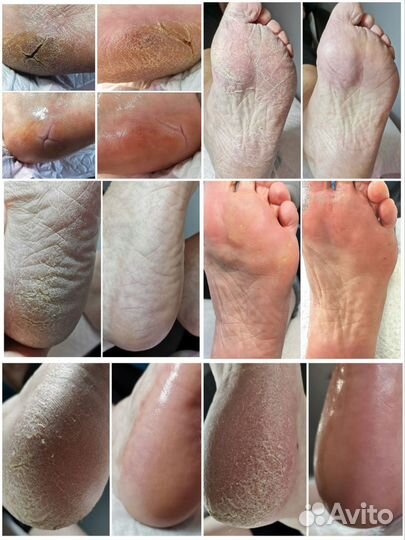 Подолог/Медицинский педикюр и маникюр