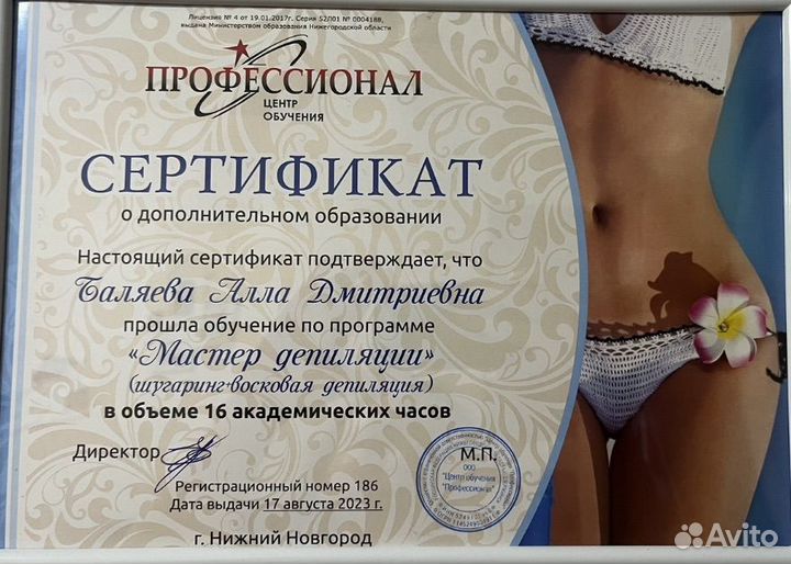 Эпиляция