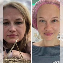 Косметолог, Чехов