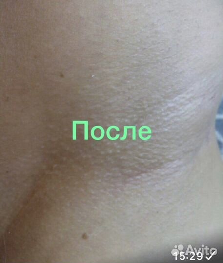 Депиляция шугаринг/воск метро Пл. Восстания