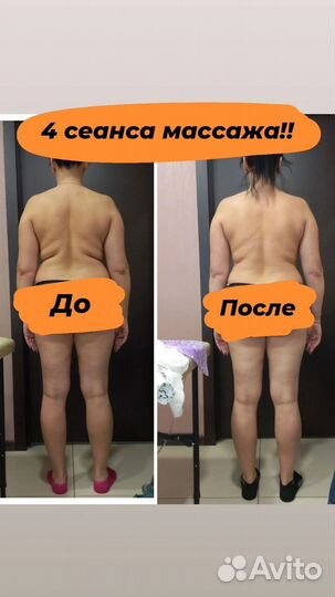 Антицеллюлитный массаж