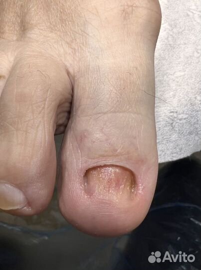 Услуги подолога