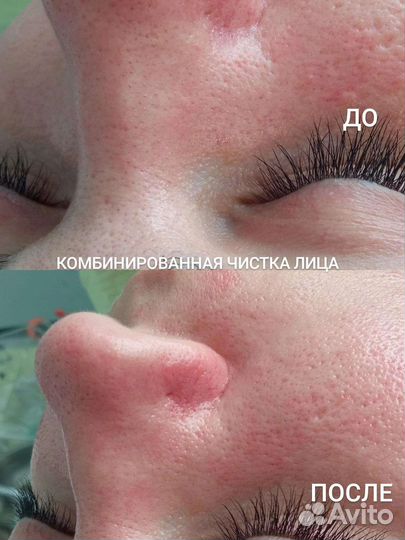 Услуги косметолога