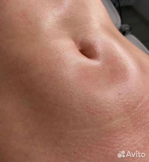 Шугаринг/Ваксинг