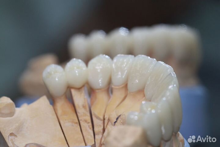 Зубные протезы. Циркон. Коронки и мосты