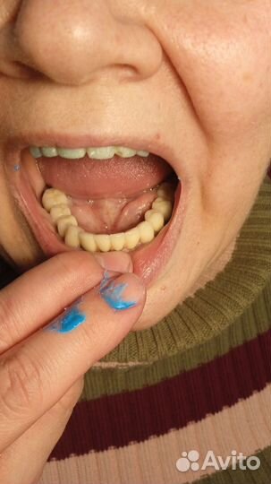 Услуги зубного техника