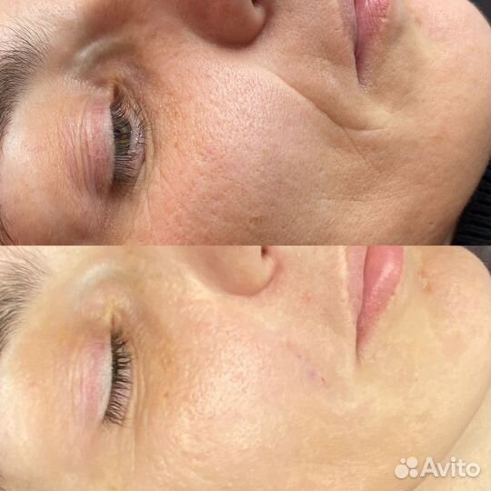 Косметолог избербаш