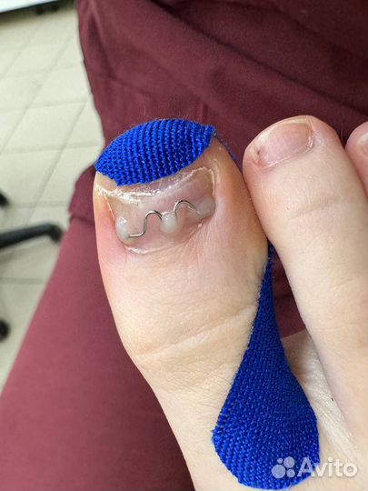 Модель к подологу