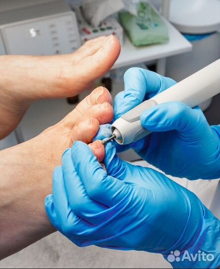 Парамедицинский педикюр