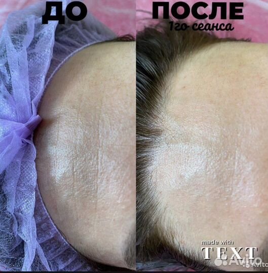 Консультация косметолога