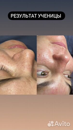 Обучение Косметолог-эстетист