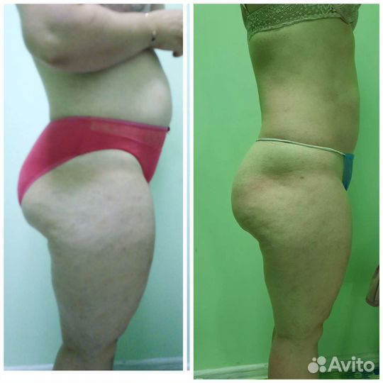 Массаж детям и взрослым / липопластика