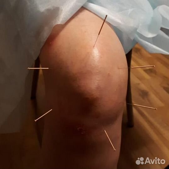 Мануальный массаж (остеопатия)