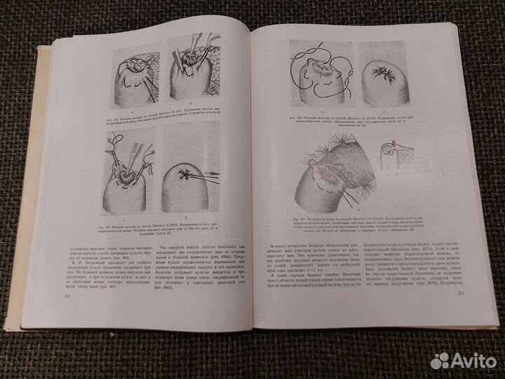 Брюшная Хирургия - И. Литтманн. 1982г, Будапешт