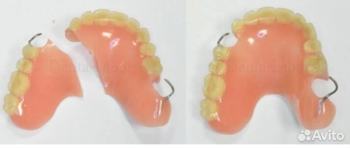 Починка протезов, изготовление несъёмных пр-ов