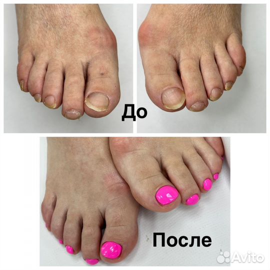 Маникюр и Педикюр