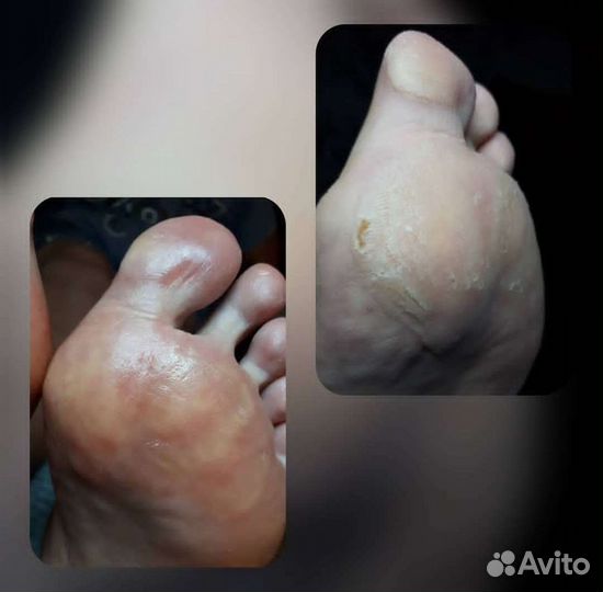 Маникюр, педикюр