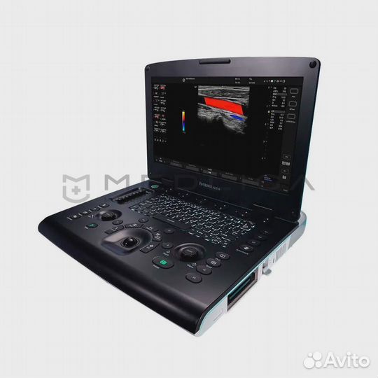 Узи аппарат GE Versana Active