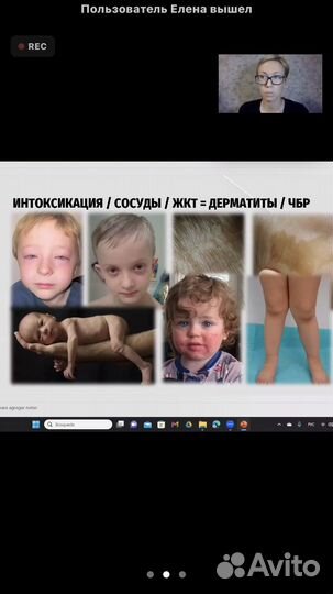 Нейропсихолог. Ранняя помощь. Сенсорная терапия