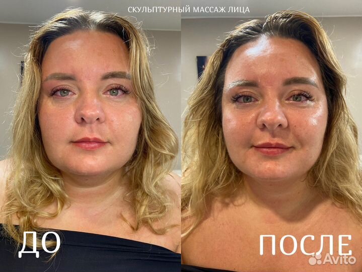 Массаж тела / Массаж лица / LPG-массаж лица и тела