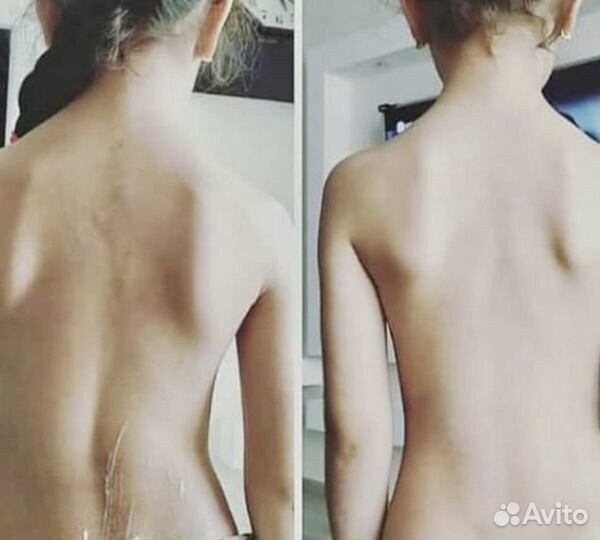 Массаж - 2 см с талии, модели