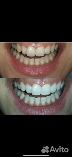 Сертификат Косметическое Отбеливание Зубов