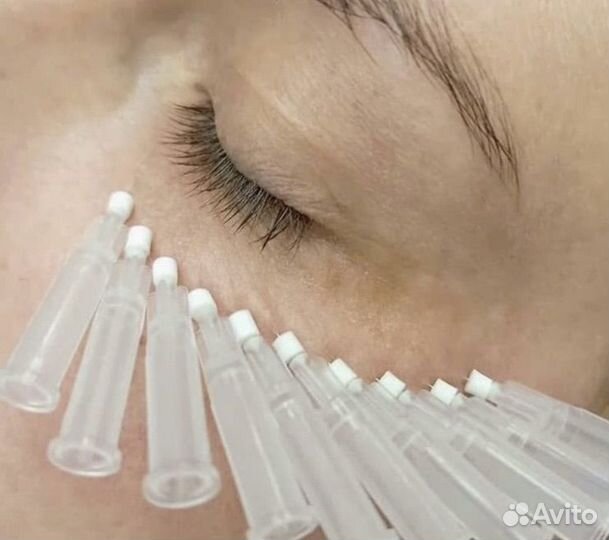 Модели на нитевой лифтинг