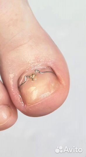 Подолог(педикюр)