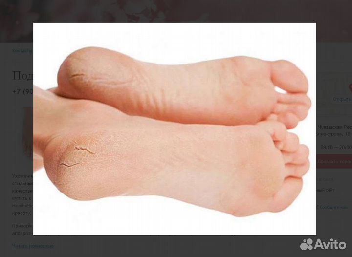 Подолог,медицинский педикюр с выездом и в салоне