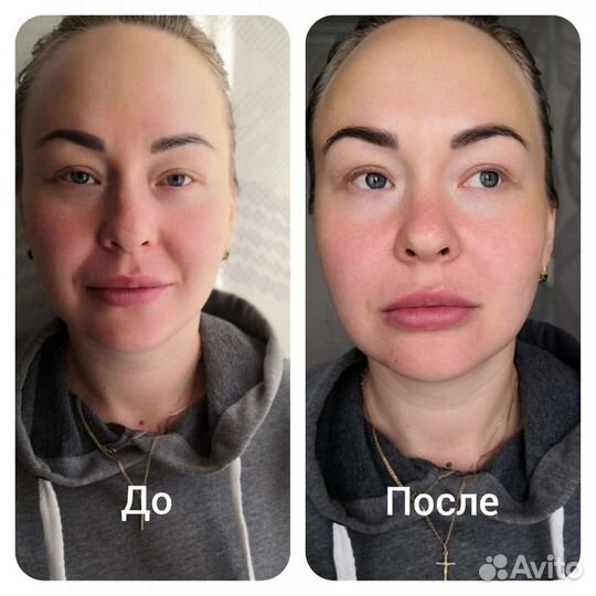 Массаж лица