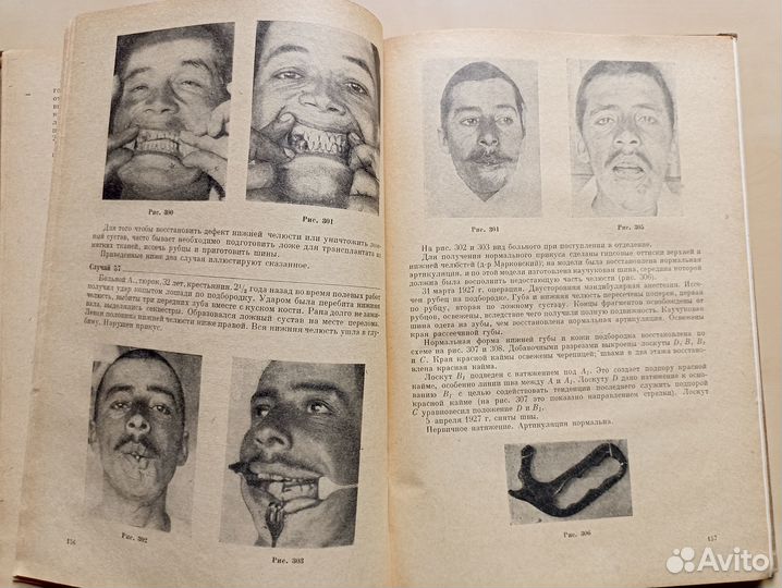 Восстановительная хирургия лица. Франкенберг. 1936