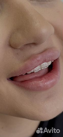 Скайсы / твинклы/ страз на зуб / tooth gems