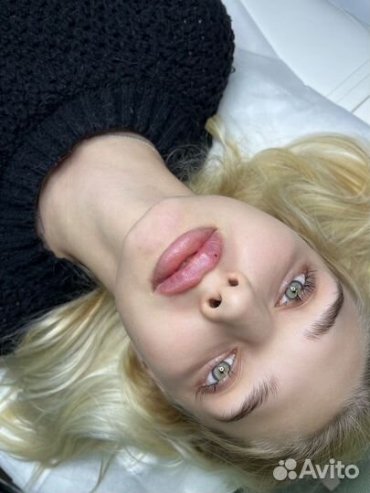 Увеличение губ