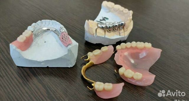 Изготовление и починка зубных протезов