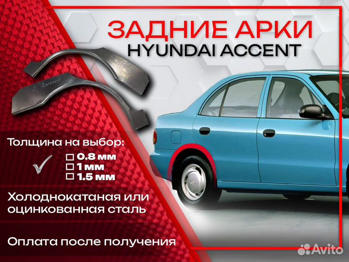 Ремонтные арки на Hyundai Accent