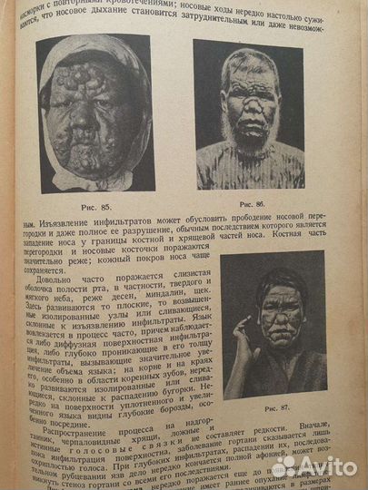 Краткий курс венерических и кожных болезней