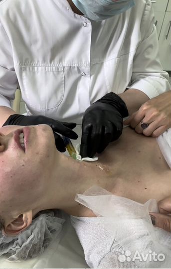 Плазмолифтинг