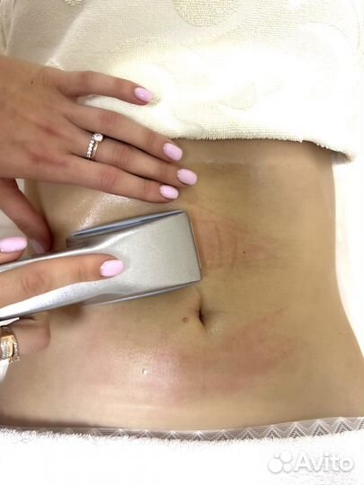 Аппаратный массаж Старвак / G5. Похудение