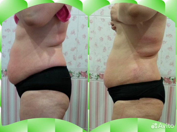 Коррекция фигуры