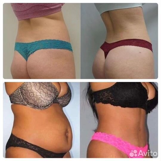 Массаж - 2 см с талии, модели