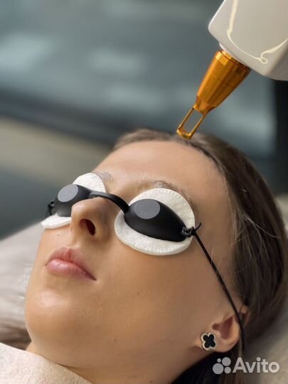 Лазерное удаление татуажа и татуировок