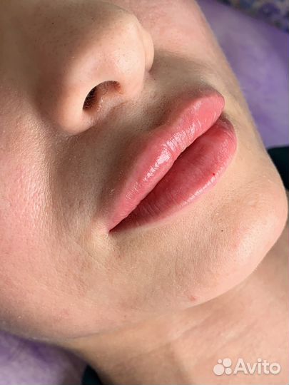 Модели на увеличение губ