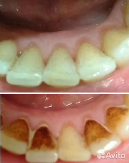 4) Устройство для чистки зубов