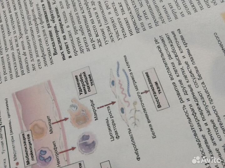 Патологическая анатомия по Роббинсу